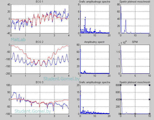 Заказать контрольную на MatLab